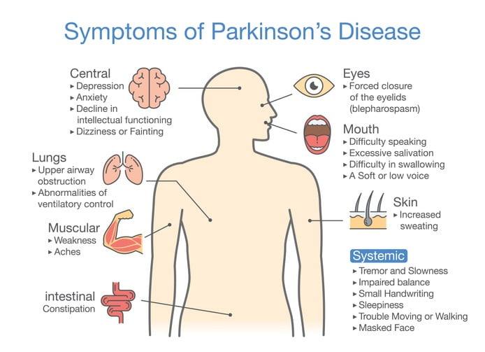 Ziekte van Parkinson symptomen